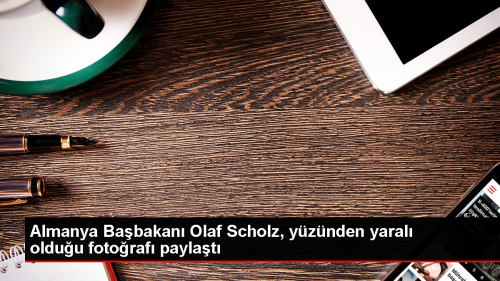 Almanya Babakan Scholz, dmesinin ardndan yaral yzn paylat