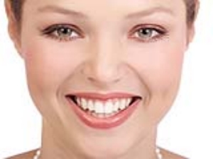Di� Beyazlatma (Bleaching)