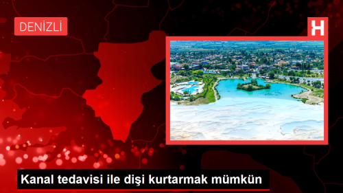 Kanal tedavisi ile dii kurtarmak mmkn