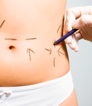 Liposuction Ne Zaman Yaptrlmal?