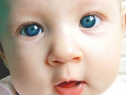 Otizmli Bebek 6 Ayl�kken Farkediliyor
