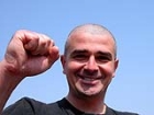 Sa� D�k�lmesinde Uygulanan Tedaviler Nelerdir?