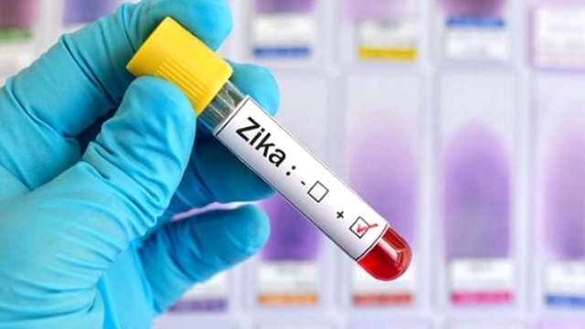 Ds�'den Asya-Pasifik'te Zika Uyar�s�