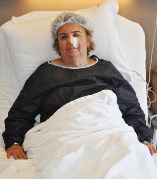 Y�z�ne Saplanan Metal Par�as�yla 58 Y�l Ya�ad�